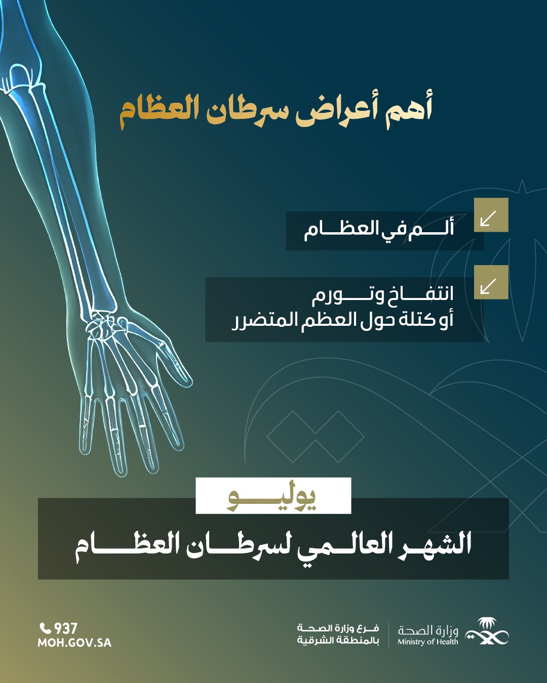 #تفاعل|
 
أهم أعراض سرطان العظام 

1- ألم في العظام 
2- انتفاخ وتورم 
أو كتلة حول العظم المتضرر 

#الشهر_العالمي_لسرطان_العظام 
#صحة_الشرقية